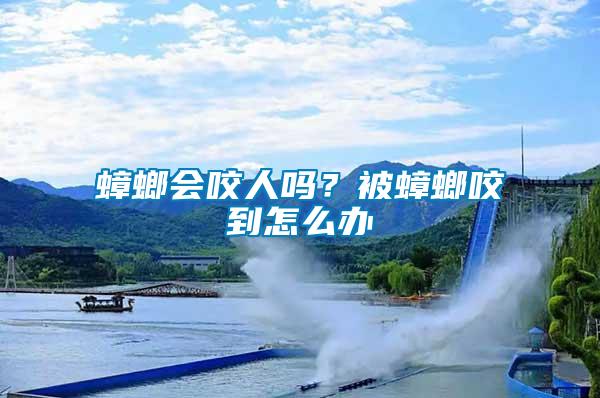 蟑螂會(huì)咬人嗎？被蟑螂咬到怎么辦